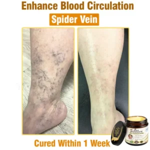 LOVILDS® Full-Body Repair Cream 15 LOVILDS® Full-Body Repair Cream