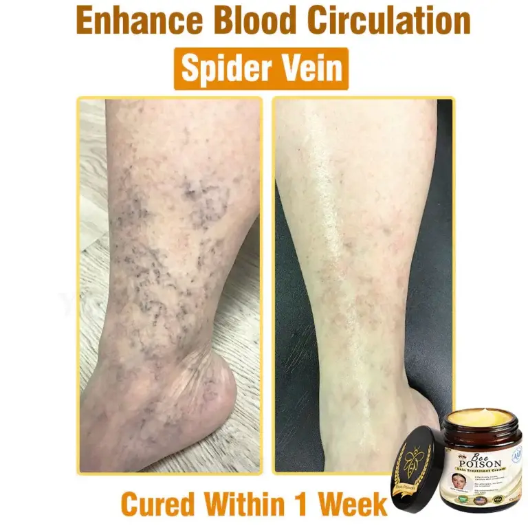 LOVILDS® Full-Body Repair Cream 5 LOVILDS® Full-Body Repair Cream