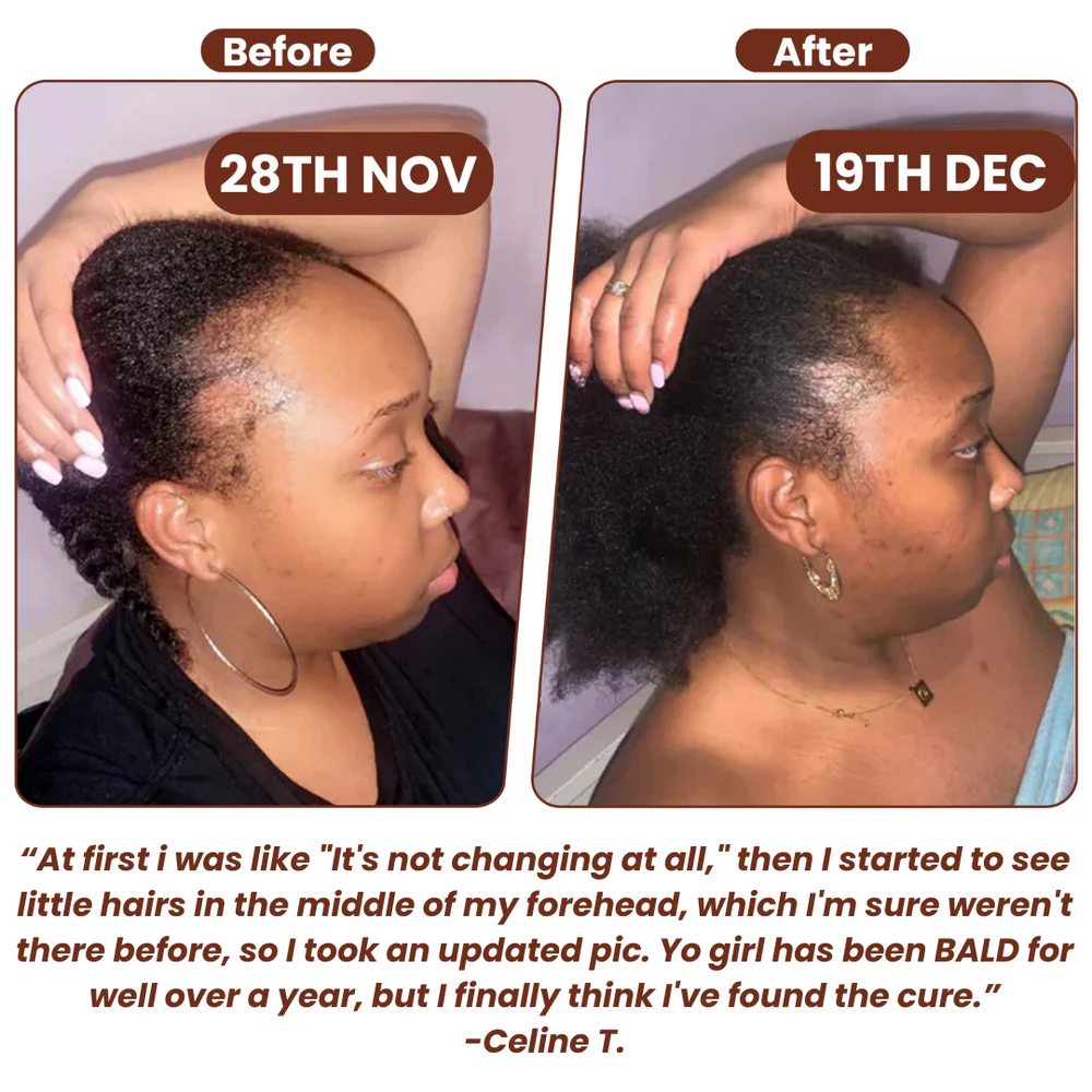 Grows Pure Batana Oil 6 Grows Pure Batana Oil