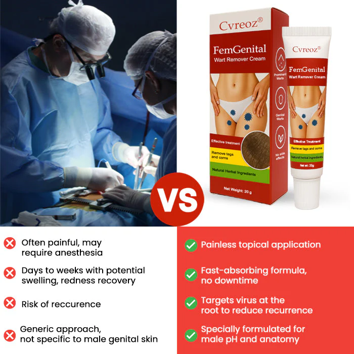 Cvreoz® FemGenital Wart Remover Cream 8 Cvreoz® FemGenital Wart Remover Cream