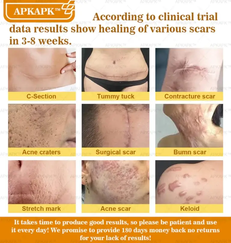 APKAPK™ Bee Venom Skin Treatment Cream 24 APKAPK™ Bee Venom Skin Treatment Cream