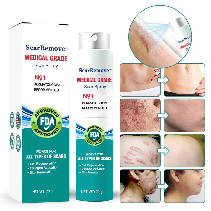 Fivfivgo™ Advanced Scar Removal Spray 1 Fivfivgo™ Advanced Scar Removal Spray