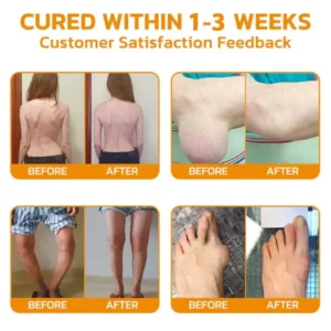 flysmus™ Bee-Venom Pain-Relief Bone Healing Cream 12 flysmus™ Bee-Venom Pain-Relief Bone Healing Cream