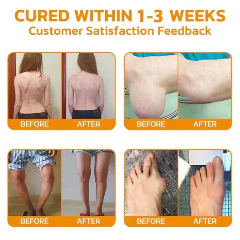 flysmus™ Bee-Venom Pain-Relief Bone Healing Cream 6 flysmus™ Bee-Venom Pain-Relief Bone Healing Cream