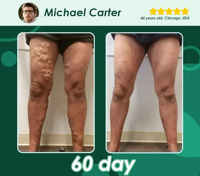 Croaie® GLP-1 Metabolic Support 5 Croaie® GLP-1 Metabolic Support