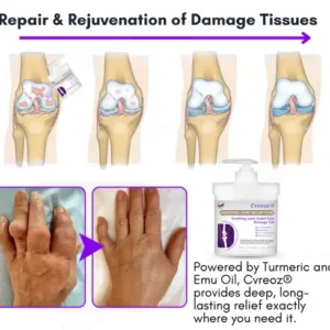 Cvreoz® Turmeric & Emu Oil Arthritis Soothing Pain Relief Massage Gel 9 Cvreoz® Turmeric & Emu Oil Arthritis Soothing Pain Relief Massage Gel