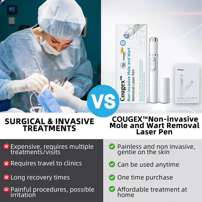 Cougex® Non-invasive Mole & Wart Removal Laser Pen