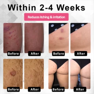 Fivfivgo® Woman's Genital HPV Healing Cream 23 Fivfivgo® Woman's Genital HPV Healing Cream