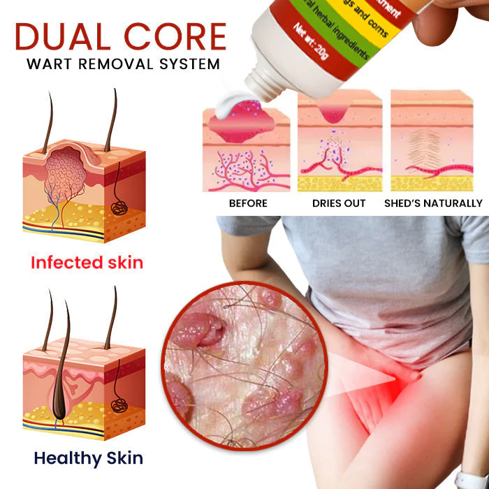 Fivfivgo® Female Genital Wart Remover Cream 5 Fivfivgo® Female Genital Wart Remover Cream