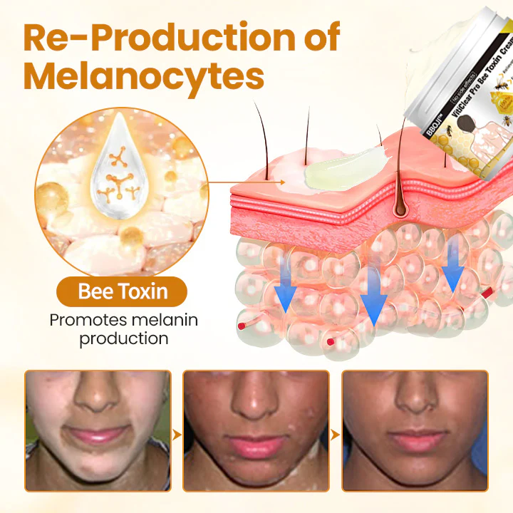 BBOJI™ VitiClear Pro Bee Toxin Cream 10 BBOJI™ VitiClear Pro Bee Toxin Cream