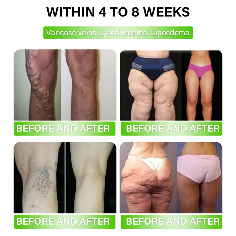 Croaie® GLP-1 Metabolic Support 11 Croaie® GLP-1 Metabolic Support