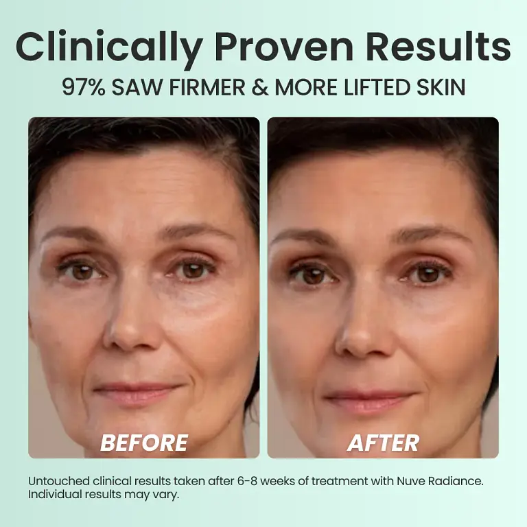 Nuve Radiance 6 Nuve Radiance