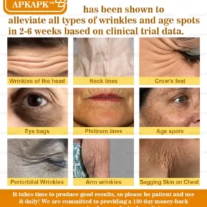 APKAPK™ Bee Venom Skin Treatment Cream 46 APKAPK™ Bee Venom Skin Treatment Cream