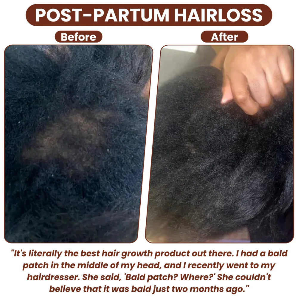 Grows Pure Batana Oil 5 Grows Pure Batana Oil