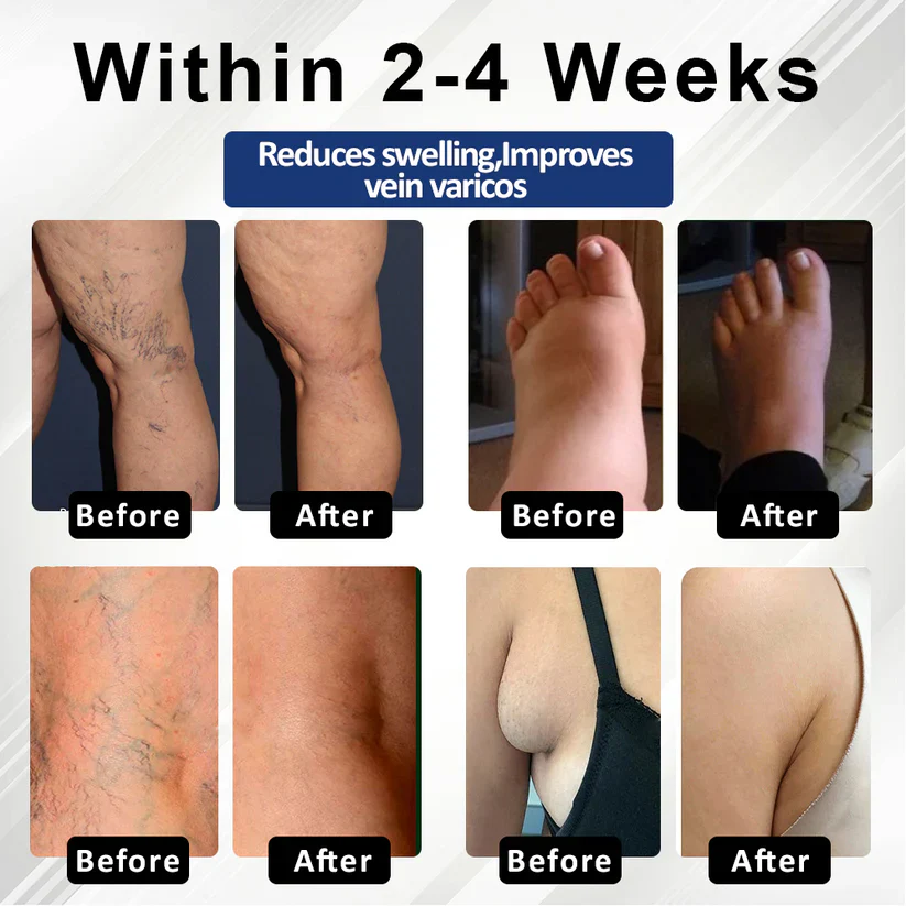 Fivfivgo® VenoHerb Black Cumin Edema Relief Balm 14 Fivfivgo® VenoHerb Black Cumin Edema Relief Balm