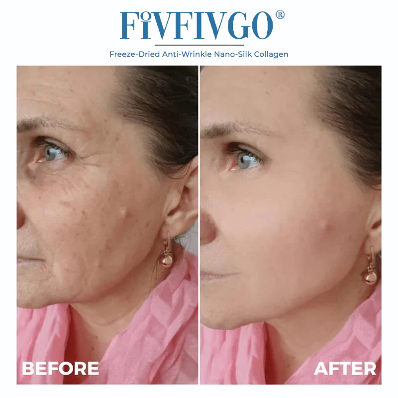 Fivfivgo® Freeze-Dried Anti-Wrinkle Nano-Silk Collagen 4 Fivfivgo® Freeze-Dried Anti-Wrinkle Nano-Silk Collagen