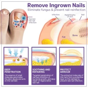 FLYCARE™ Bee Venom Nail Fungus Spray 8 FLYCARE™ Bee Venom Nail Fungus Spray