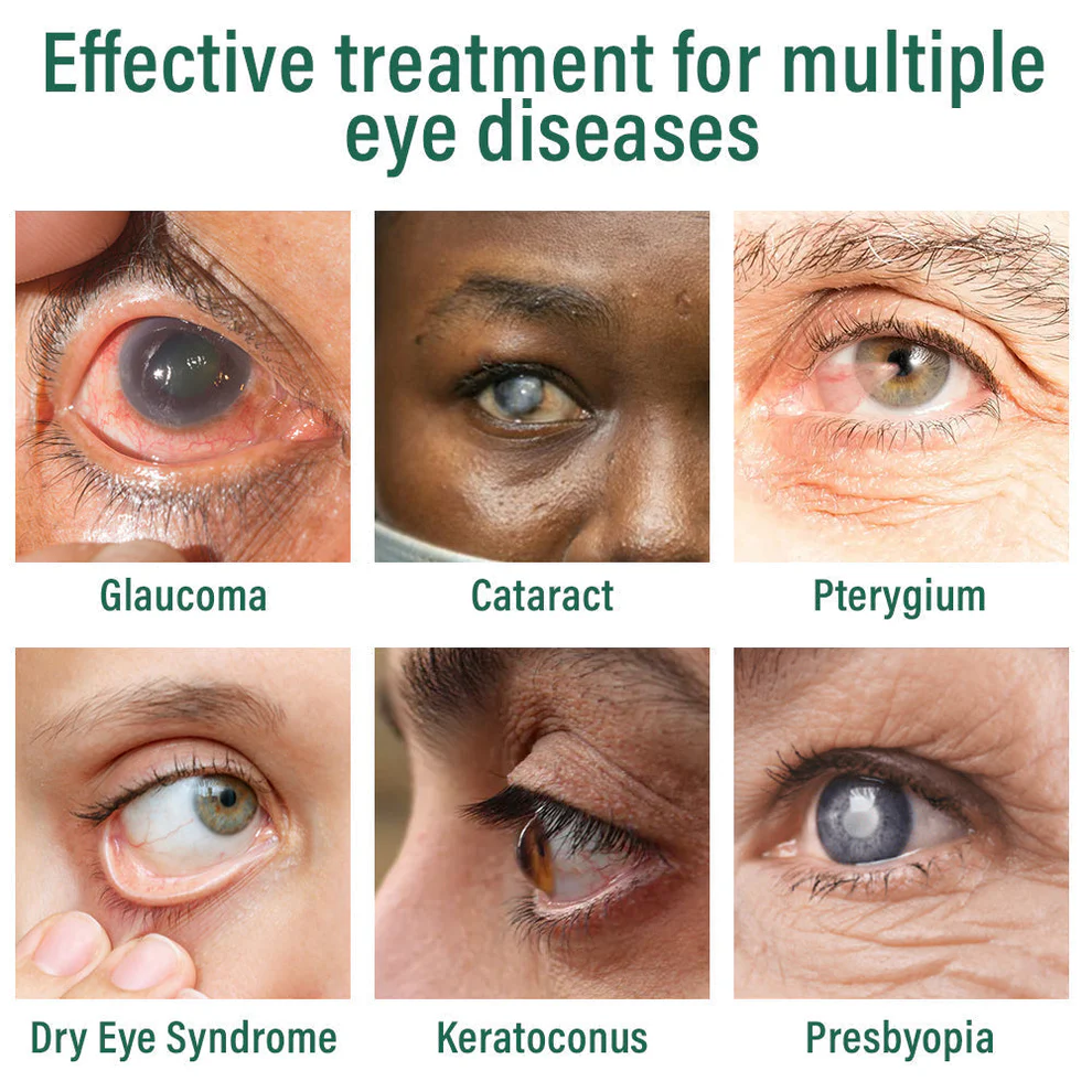 Fivfivgo® Nano Eye Drops Serum 6 Fivfivgo® Nano Eye Drops Serum