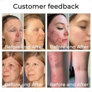 Fivfivgo™ Therapeutic Horse Oil Cream 27 Fivfivgo™ Therapeutic Horse Oil Cream