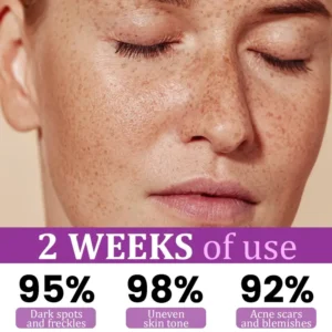 Ceoerty® MelantraX Advanced Anti-Hyperpigmentation Essence 13 Ceoerty® MelantraX Advanced Anti-Hyperpigmentation Essence