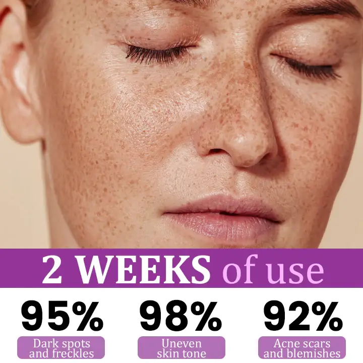 Ceoerty® MelantraX Advanced Anti-Hyperpigmentation Essence 7 Ceoerty® MelantraX Advanced Anti-Hyperpigmentation Essence