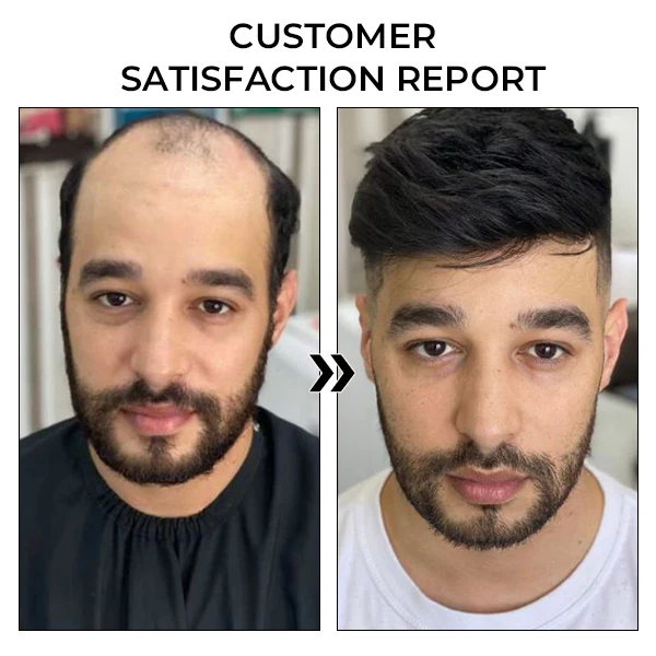 Fivfivgo™ BeeGrow Follicle Reviving Hair Essence 12 Fivfivgo™ BeeGrow Follicle Reviving Hair Essence