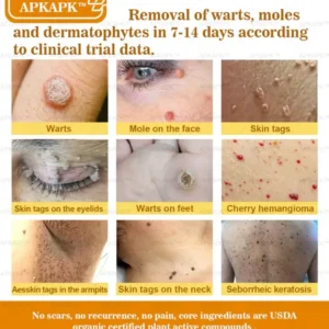 APKAPK™ Bee Venom Skin Treatment Cream 45 APKAPK™ Bee Venom Skin Treatment Cream