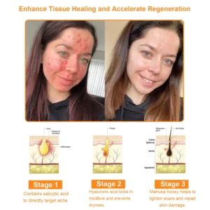 Fivfivgo™ 7-Day Multi-Effect All-in-One Skincare Cream 21 Fivfivgo™ 7-Day Multi-Effect All-in-One Skincare Cream