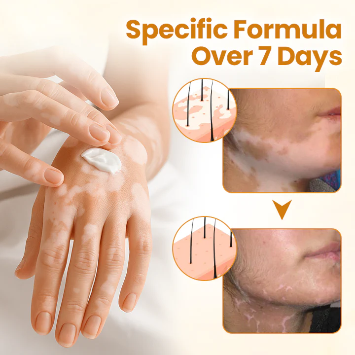 BBOJI™ VitiClear Pro Bee Toxin Cream 8 BBOJI™ VitiClear Pro Bee Toxin Cream