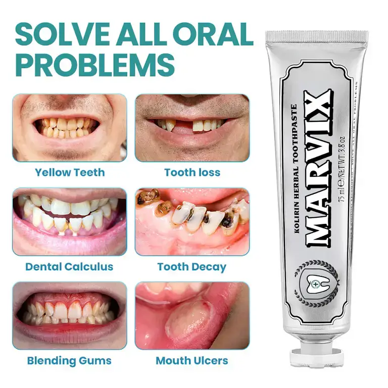 Marvix™ Kolirin Herbal Toothpaste – Solve all Oral Problems 6 Marvix™ Kolirin Herbal Toothpaste – Solve all Oral Problems