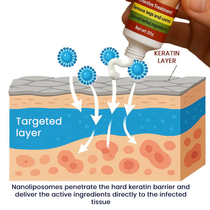 Cvreoz® FemGenital Wart Remover Cream 6 Cvreoz® FemGenital Wart Remover Cream