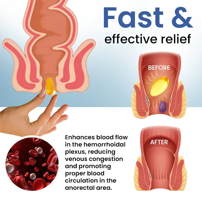 Fivfivgo® Natural Hemorrhoid Capsules 5 Fivfivgo® Natural Hemorrhoid Capsules