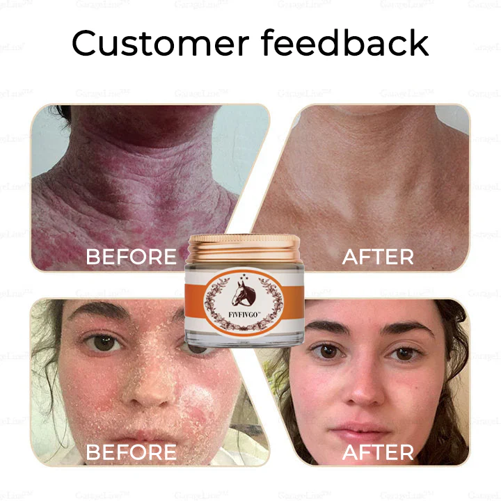 Fivfivgo™ Therapeutic Horse Oil Cream 13 Fivfivgo™ Therapeutic Horse Oil Cream