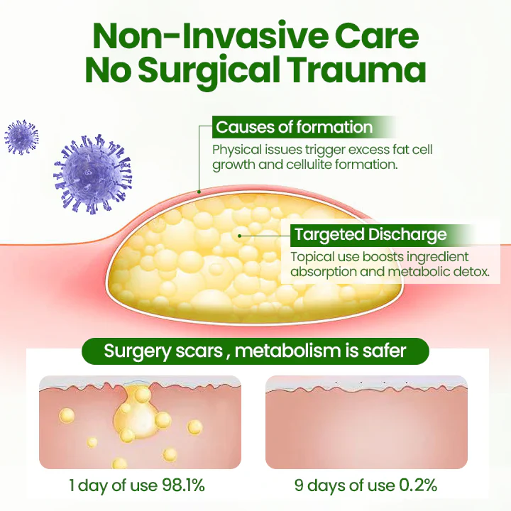 Fivfivgo® KnotAway Lipoma Removal Cream 7 Fivfivgo® KnotAway Lipoma Removal Cream