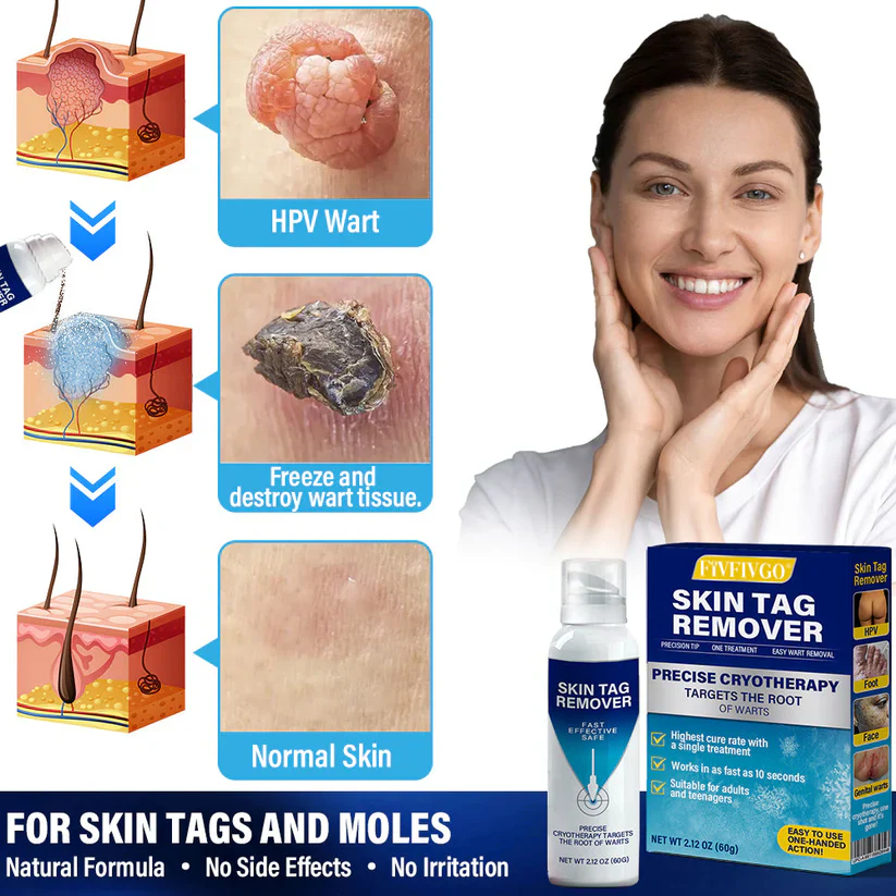 Fivfivgo® TagRecede Cryo Treatment Spray 3 Fivfivgo® TagRecede Cryo Treatment Spray