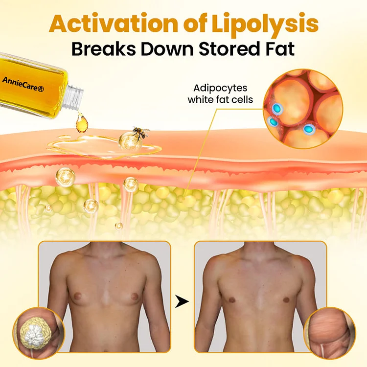 AnnieCare® ThermoFirm Bee Venom Gynecomastia-Oil 7 AnnieCare® ThermoFirm Bee Venom Gynecomastia-Oil