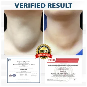 Fivfivgo® VenoHerb Black Cumin Edema Relief Balm 25 Fivfivgo® VenoHerb Black Cumin Edema Relief Balm