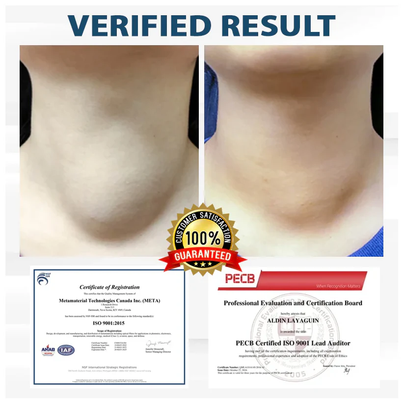 Fivfivgo® VenoHerb Black Cumin Edema Relief Balm 12 Fivfivgo® VenoHerb Black Cumin Edema Relief Balm