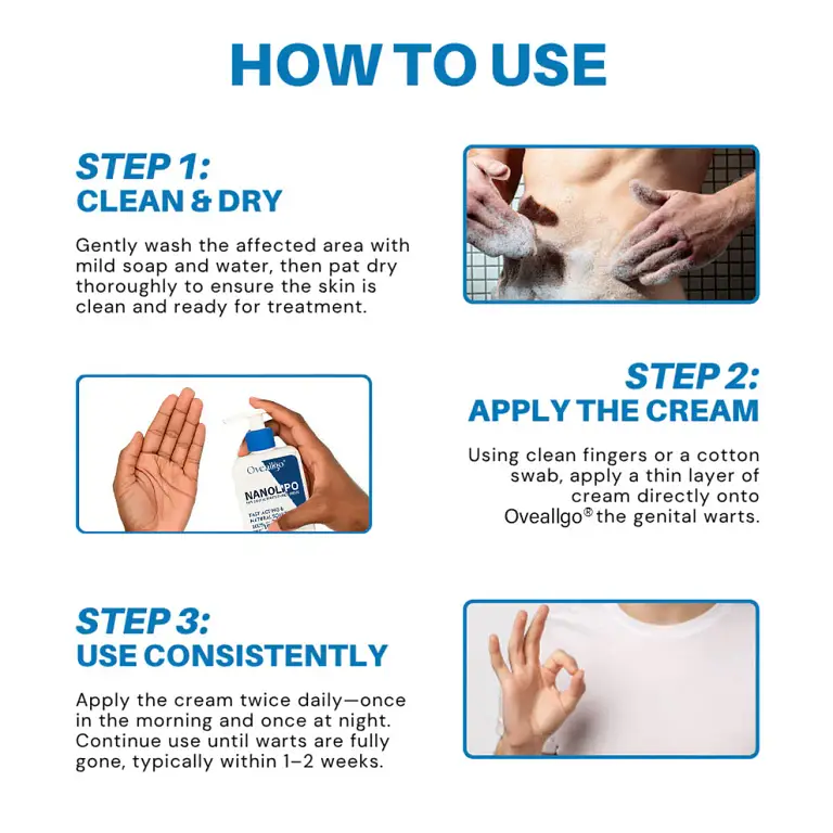 Oveallgo® NanoLipo HPV Genital Warts Eraser Cream 5 Oveallgo® NanoLipo HPV Genital Warts Eraser Cream