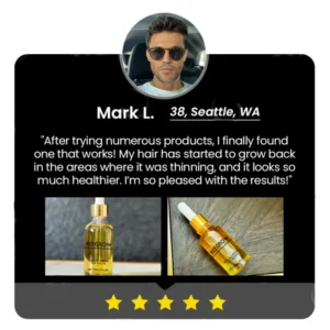 Fivfivgo™ BeeGrow Follicle Reviving Hair Essence 23 Fivfivgo™ BeeGrow Follicle Reviving Hair Essence