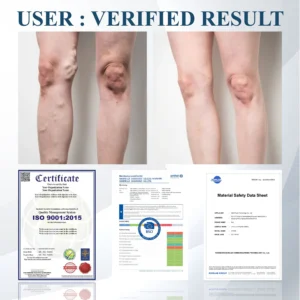 Fivfivgo® Black Cumin Edema Soothing Herbal Cream 23 Fivfivgo® Black Cumin Edema Soothing Herbal Cream