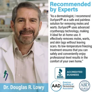 Ourlyard® TagRecede Cryo Treatment Spray 5 Ourlyard® TagRecede Cryo Treatment Spray