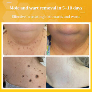 Flysmus® Bee Venom All-in-One Cream 15 Flysmus® Bee Venom All-in-One Cream