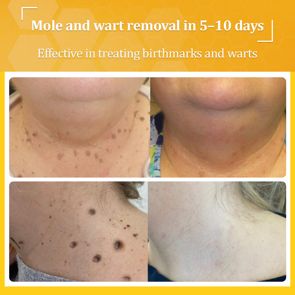 Flysmus® Bee Venom All-in-One Cream 7 Flysmus® Bee Venom All-in-One Cream