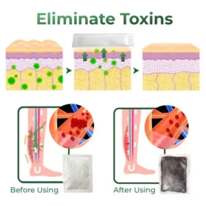 Cvreoz® Varicose Vein Relief Herbal Foot Patch 15 Cvreoz® Varicose Vein Relief Herbal Foot Patch