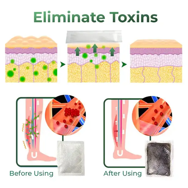 Cvreoz® Varicose Vein Relief Herbal Foot Patch 7 Cvreoz® Varicose Vein Relief Herbal Foot Patch