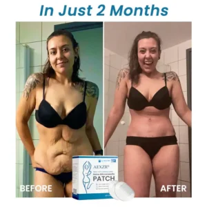 AEXZR® SMGT-GLP1 & Matrixyl 3000 Nano Microneedle Patch 21 AEXZR® SMGT-GLP1 & Matrixyl 3000 Nano Microneedle Patch