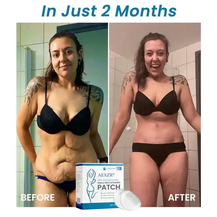 AEXZR® SMGT-GLP1 & Matrixyl 3000 Nano Microneedle Patch 10 AEXZR® SMGT-GLP1 & Matrixyl 3000 Nano Microneedle Patch
