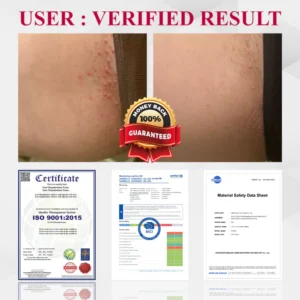 Fivfivgo® Woman's Genital HPV Healing Cream 21 Fivfivgo® Woman's Genital HPV Healing Cream