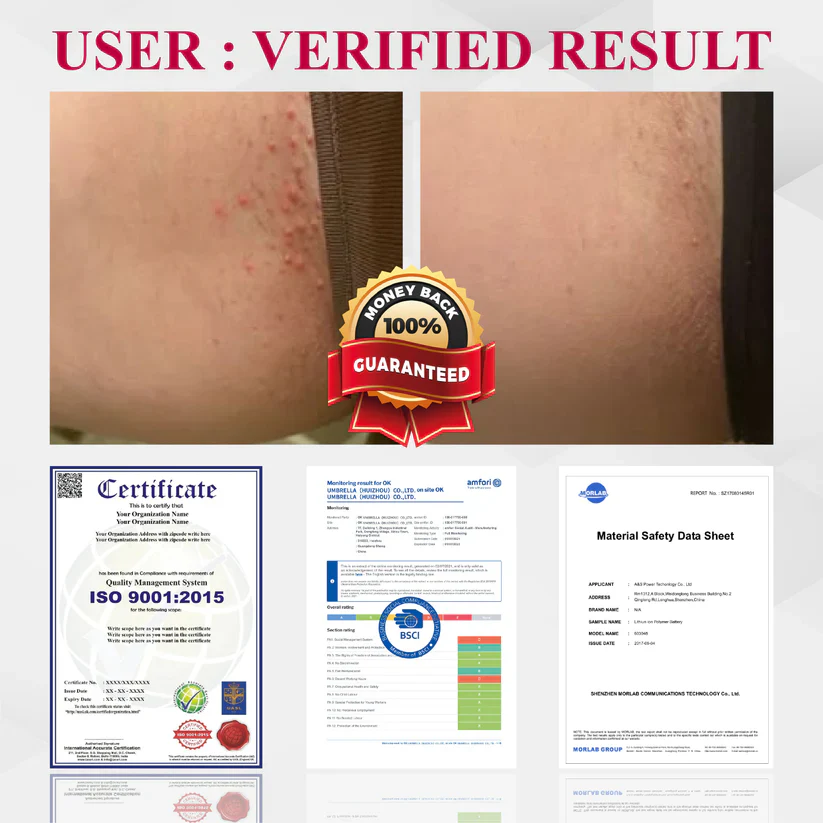 Fivfivgo® Woman's Genital HPV Healing Cream 10 Fivfivgo® Woman's Genital HPV Healing Cream